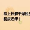 臉上長(zhǎng)癬干燥脫皮還癢可以用克霉唑乳膏嗎（臉上長(zhǎng)癬干燥脫皮還癢）