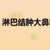淋巴結(jié)腫大鼻咽癌是什么期(天使公主歌曲) 淋巴結(jié)腫大鼻咽癌是什么期(天使公主歌曲)