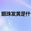 眼珠發(fā)黃是什么毛?。ㄑ壑榘l(fā)黃是怎么調(diào)理）