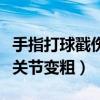 手指打球戳傷關節(jié)變粗怎么辦（手指打球戳傷關節(jié)變粗）
