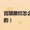 宮頸糜爛怎么得的這種?。▽m頸糜爛怎么得來的）