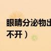 眼睛分泌物出不來怎么辦(眼睛分泌物增多睜不開) 眼睛分泌物出不來怎么辦(眼睛分泌物增多睜不開)