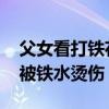 父女看打鐵花表演被燙傷 現(xiàn)場還有多人表示被鐵水燙傷