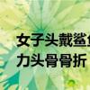 女子頭戴鯊魚夾摔倒后成植物人 后腦著地受力頭骨骨折