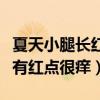 夏天小腿長紅點(diǎn)點(diǎn)很癢怎么回事（夏天小腿上有紅點(diǎn)很癢）
